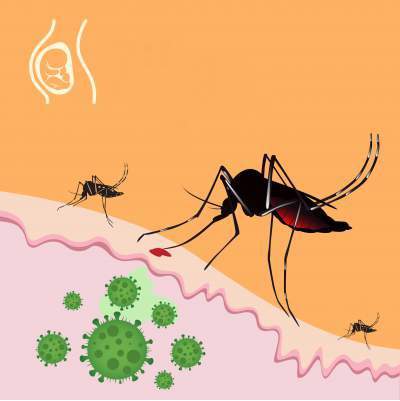 Revealing the Best Home Remedies for Chikungunya