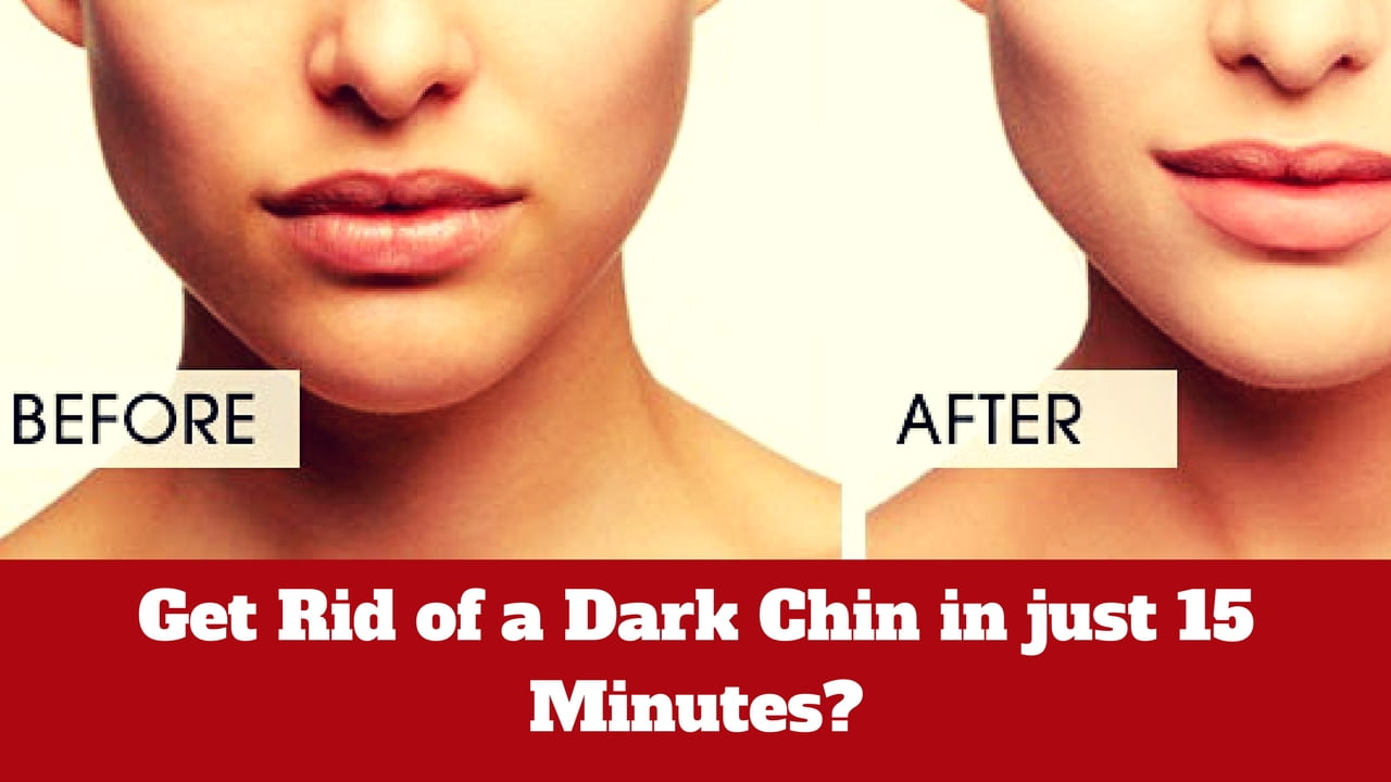 Get Rid of a Dark Chin