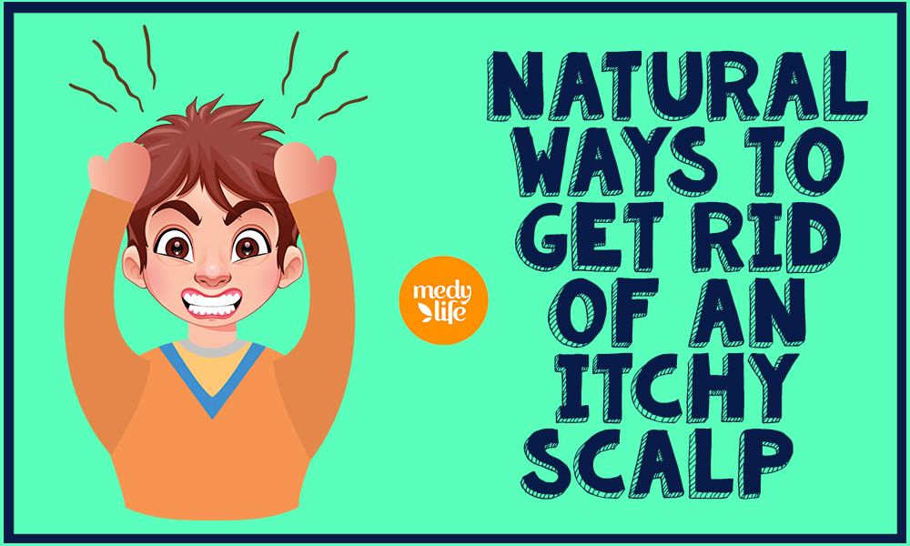 Ways to Get Rid of an Itchy Scalp