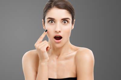 How to Get Rid of White Spots on the Face